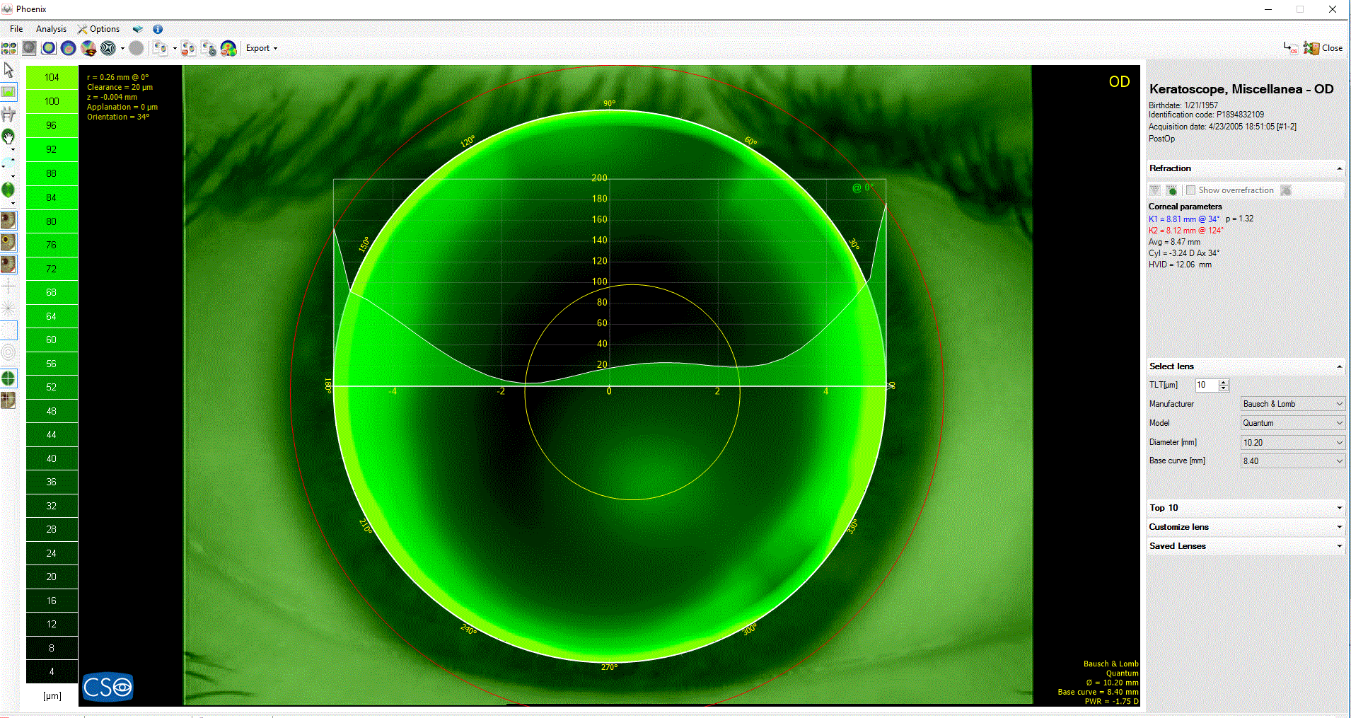 Adaptación de lentes de contacto (Auto-fit)