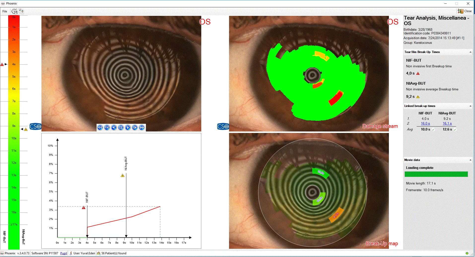 Análisis Exhaustivo de la Película Lagrimal