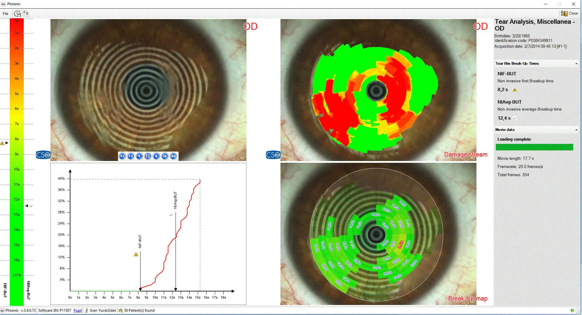 Análisis Exhaustivo de la Película Lagrimal