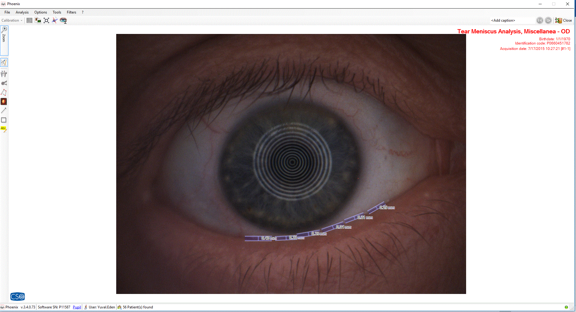 Análisis Exhaustivo de la Película Lagrimal